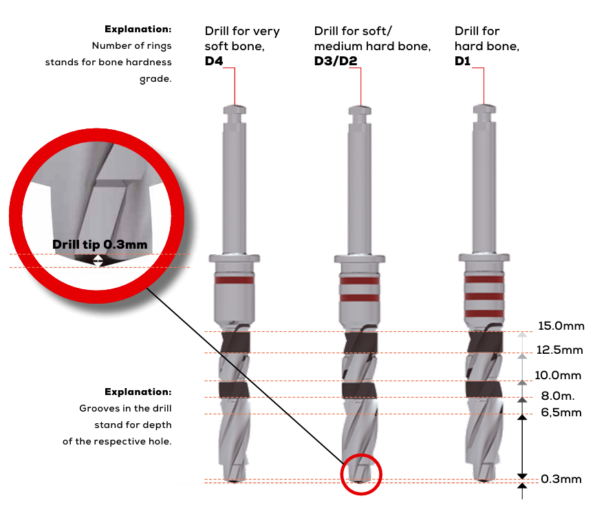 ICX-P5 Intraoral Scanner